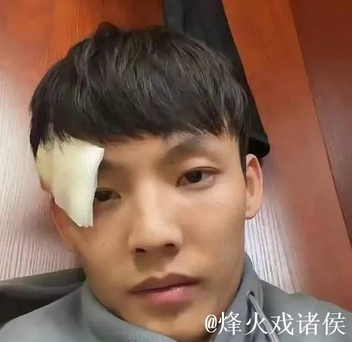 被邬挺嘉重伤后首发声，徐杰回应大格局，同曦队老总请吃饭赔罪